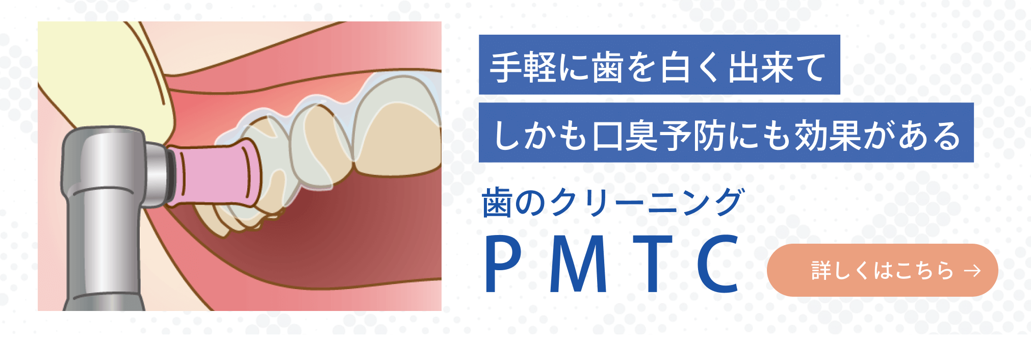歯のクリーニングPMTC