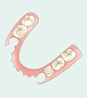 保険適応外の入れ歯