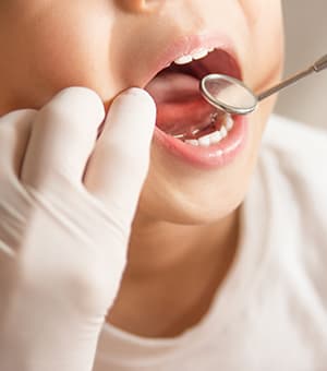 子どもの虫歯治療