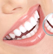 白い歯にする治療